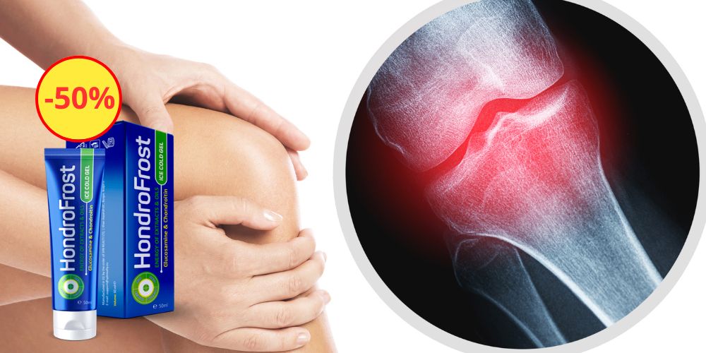 Hondrofrost España Página Oficial